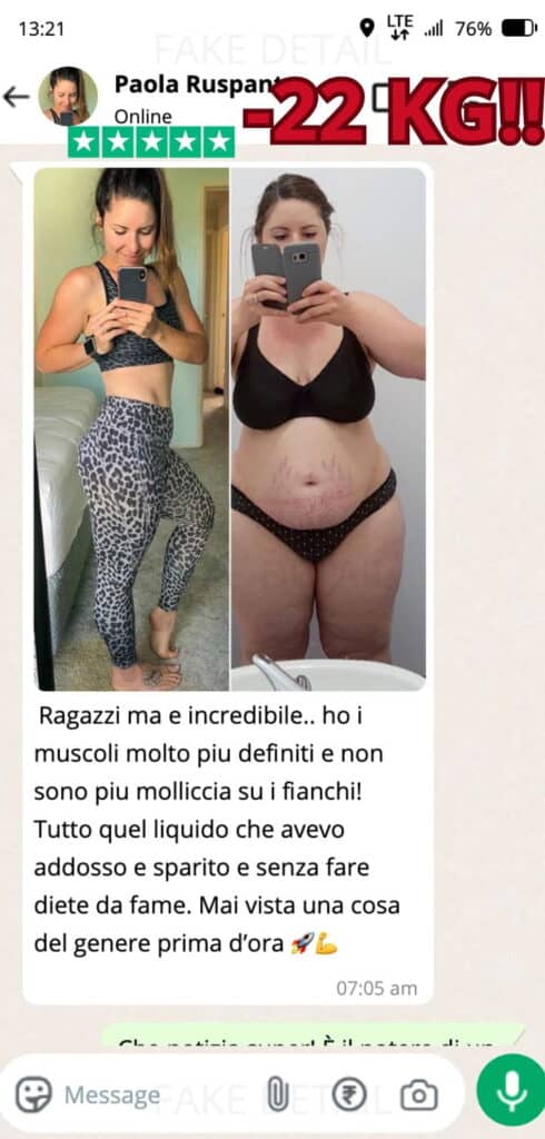Prima e dopo la perdita di peso significativa.