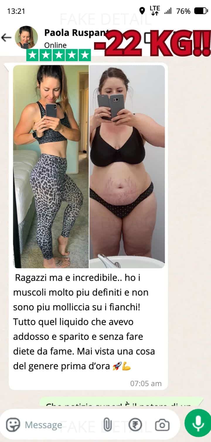 Prima e dopo la perdita di peso significativa.