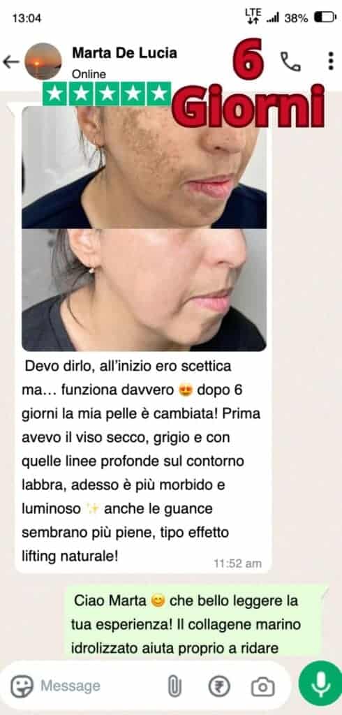 Dopo 6 giorni, miglioramenti visibili della pelle con crema anti-invecchiamento.