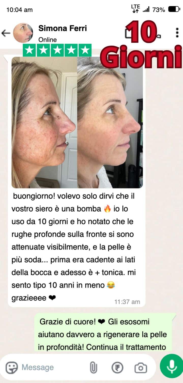Prima e dopo trattamento viso con esomi, pelle più liscia e tonica.