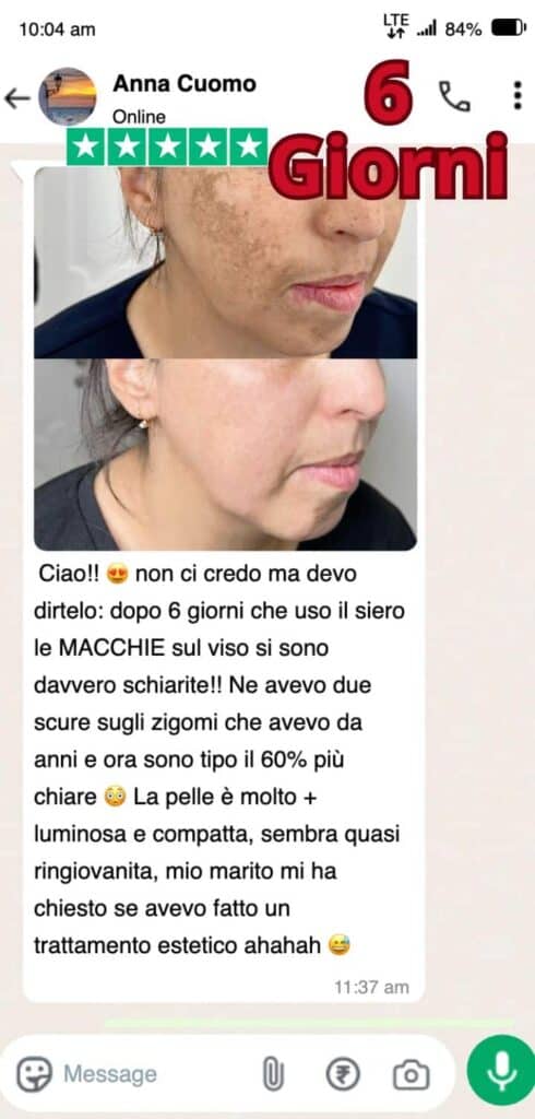 Prima e dopo trattamento viso con erbe e siero naturale.