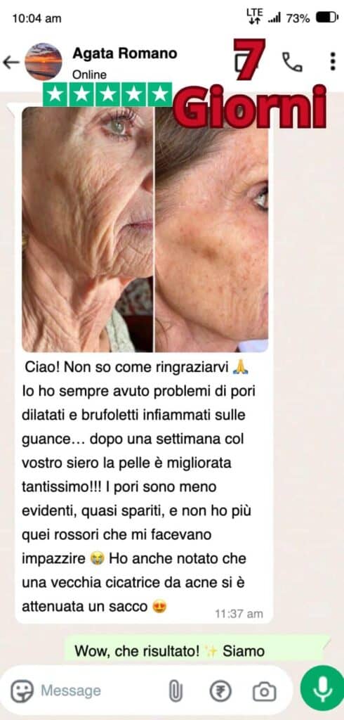 Prima e dopo trattamento naturale delle cicatrici con erbe.